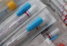 Počinju testiranja u Univerzitetskoj bolnici