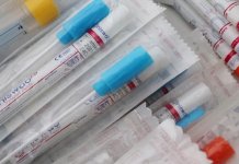 Tri novozaražene osobe sa blagim simptomima