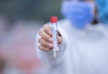 Zaraženo 349 lica, 19 preminulo