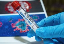 Novozaraženo 16 osoba, aktivno zaraženih 39