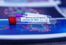 Zaraženo sedam osoba