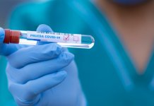 Pogoršana situacija, poštovati propisane mjere