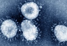 Još 125 zaraženih u Republici Srpskoj, jedno lice preminulo