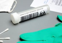 U RS testirano 292 lica, pozitivno 84, preminulo četvoro