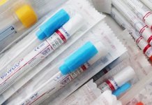 Cijena komercijalnih testova od danas 150 KM