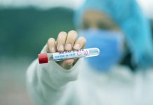 Zaraženo sedam muškaraca i pet žena