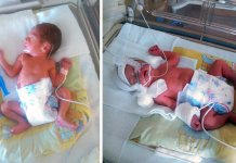 Banka humanog mlijeka sjajan projekat – od velikog značaja za majke