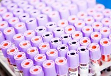 Zaraženo još 413, preminulo 16 lica