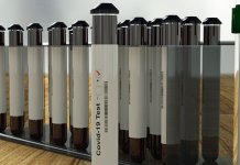 Pozitivno 347 osoba, 18 preminulo