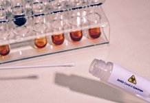 Zaraženo 13 lica, nema preminulih