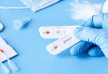 Zaražena 74 lica, 28 preminulo