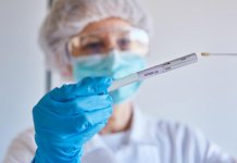 Virus potvrđen kod 63 lica, prijavljena tri smrtna slučaja