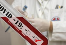 Pozitivno 1.057 lica, najviše od početka pandemije