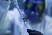 Zaražena 425 lica, 27 preminulih