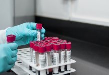 Zaražena 403 lica, preminulo 20