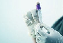 Zaražena još 154 lica, preminulo 10