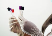 Virus korona potvrđen kod 15 osoba, dvije preminule