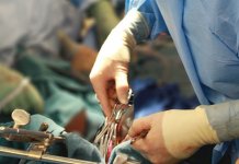 Pacijentima na raspolaganju usluge vaskularnog hirurga