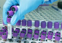 Zaražene još 172 osobe, preminulo osam