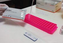 Dvoje preminulih i 23 zaražena virusom korona