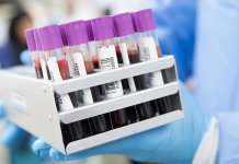 Antitijеla u Srpskoj ima 95 odsto stanovnika