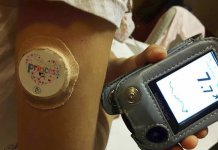 Senzori spasavaju život dijabetičara, posebno djece