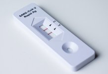 Infekcija potvrđena kod 13 lica, preminuo stariji muškarac