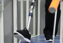 Kvalitetnije proteze za 60 fočanskih amputiraca