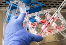 U Hrvatskoj potvrđеn prvi slučaj majmunskih boginja