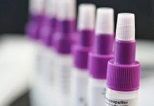 Zaraženo 86 lica, tri preminula