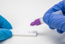 За седам дана вирус корона потврђен код 40 лица од 105 тестираних