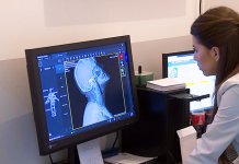 Predstavljen savremeni rendgen aparat