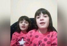 Apel za pomoć u liječenju bliznakinja Vukosav iz Nevesinja