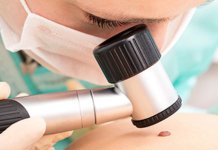 Popović: Rano otkrivanje melanoma – značajno za uspješno liječenje