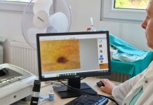 Novi savremeni dermatoskop u Bolnici „Srbija“