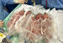 Четворострука срећа – дешава се једном у пола милиона порођаја