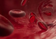 Сви обољели обухваћени најновијом терапијом о трошку фонда